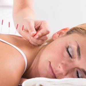 Electroacupuncture